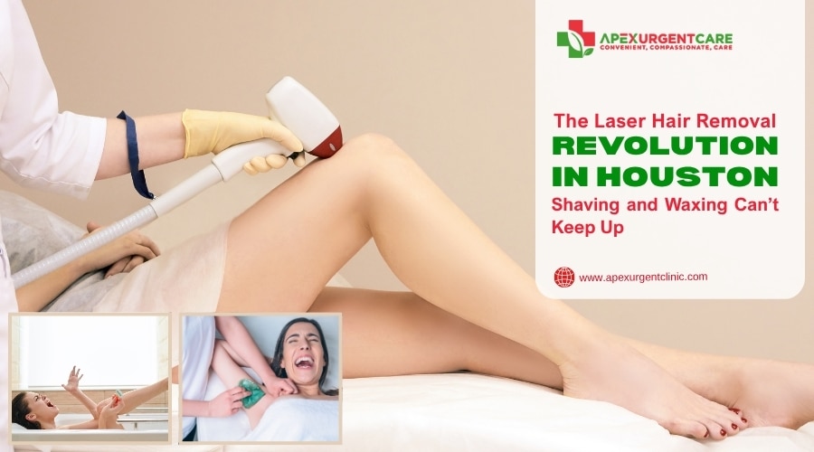 The Laser Hair Removal Revolution in Houston: Shaving and Waxing Can’t Keep Up