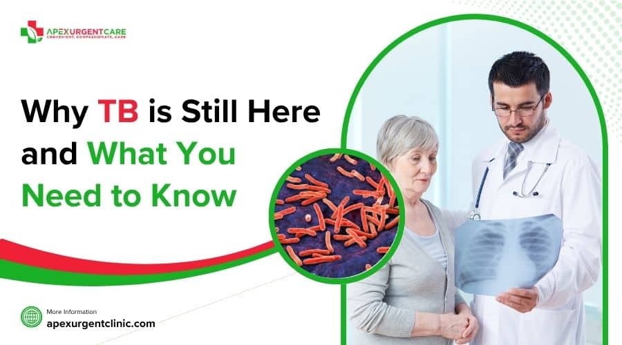 Why TB is Still Here and What You Need to Know